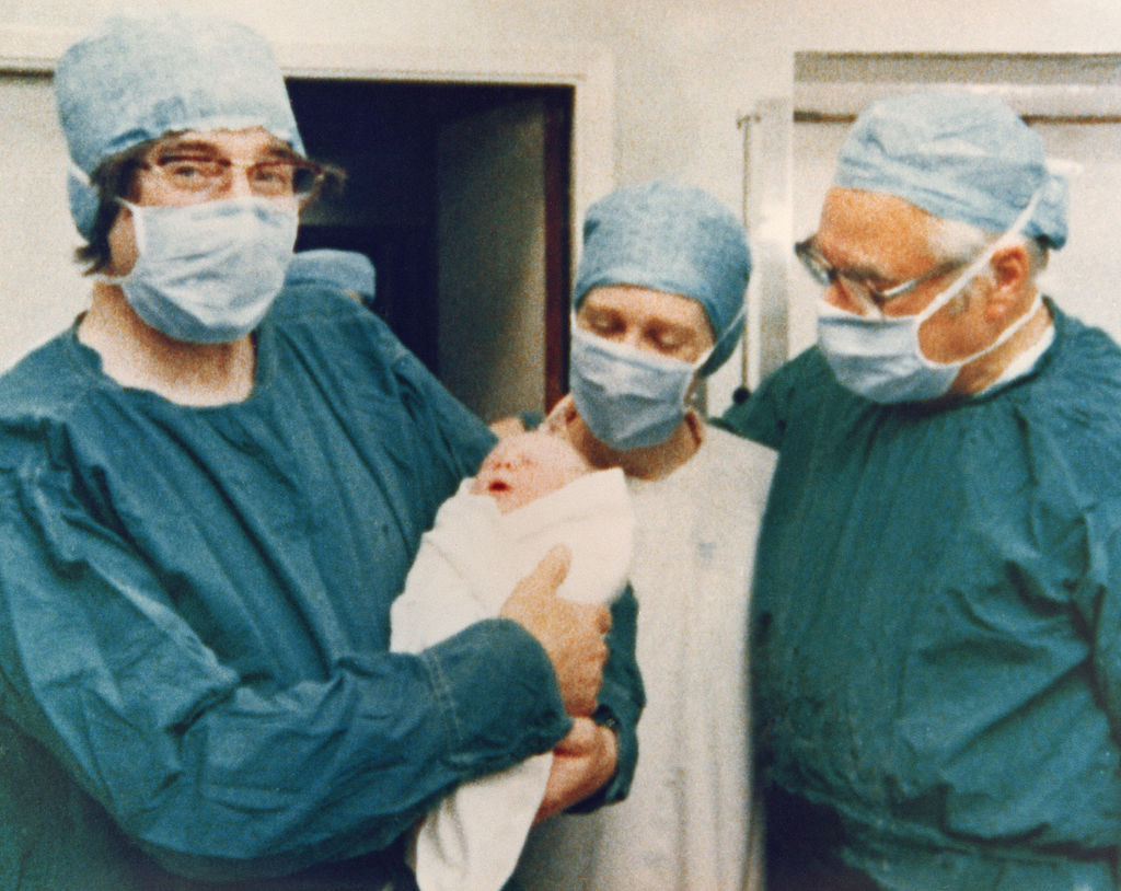 doctors holding the world's first test tube baby in a hospital