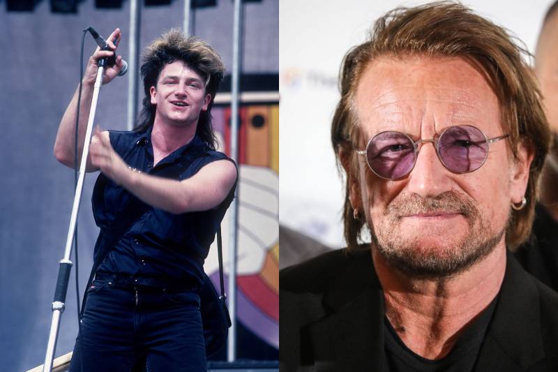 bono before and after photos