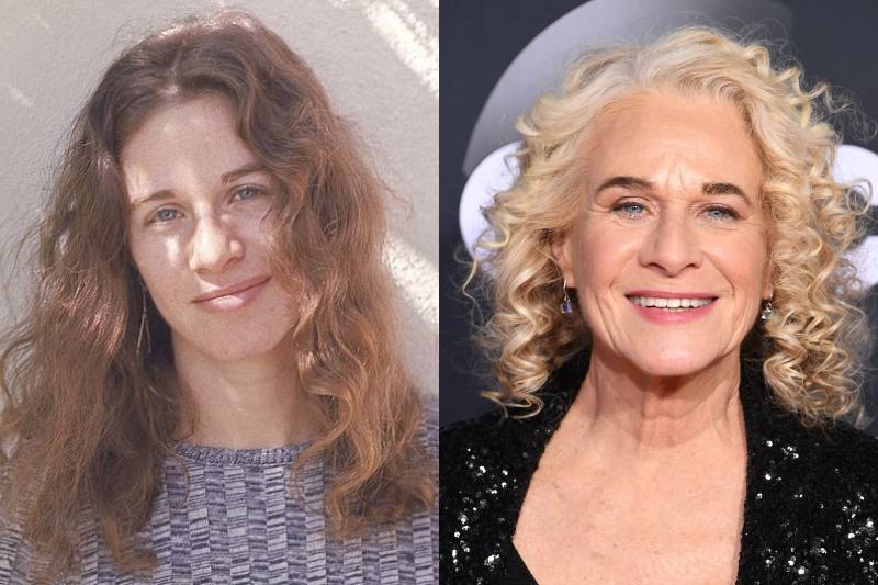 carole king before and after photos