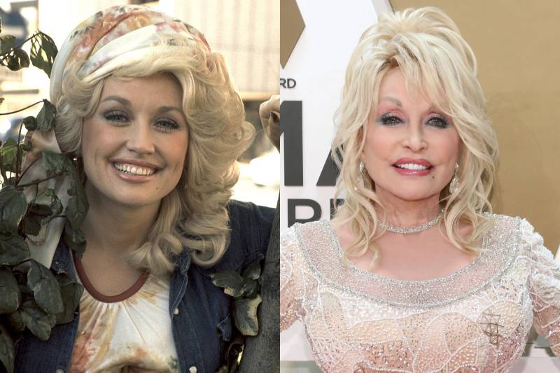 dolly parton before and after images