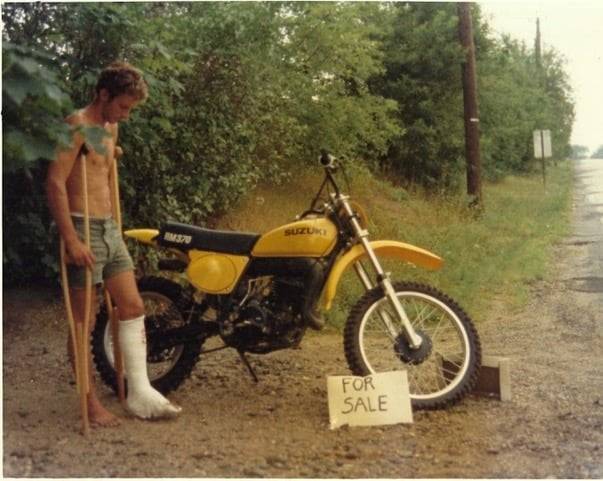 shirtless man with broken leg standing next to motorcycle for sale