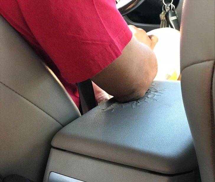 elbow rest destroyed after years of sitting