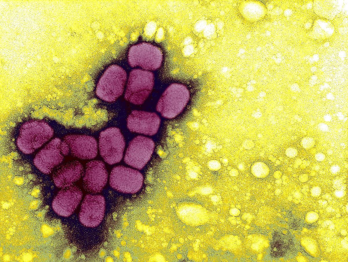 A colored diagram shows cells of the smallpox virus.