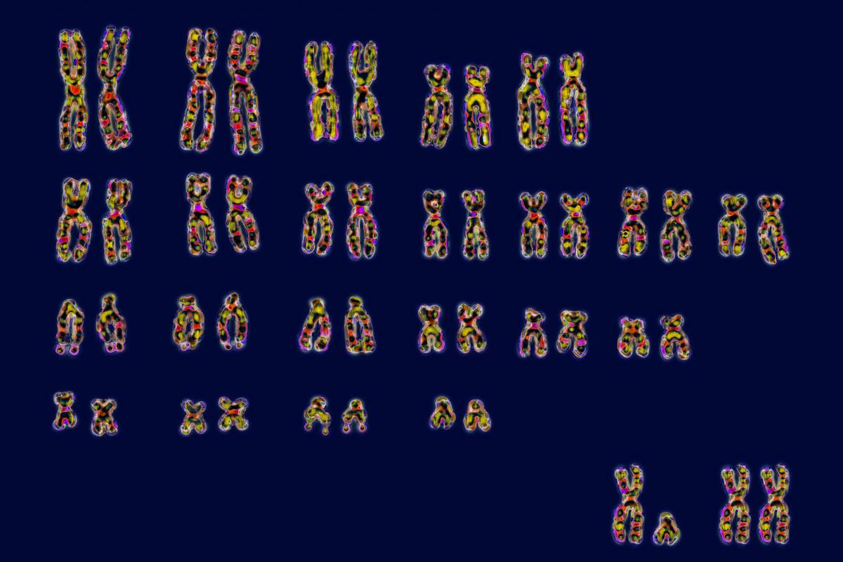 Karyotype