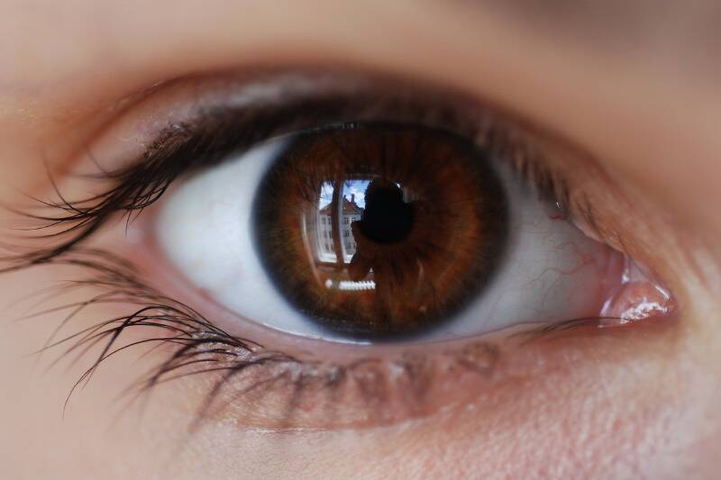 othe (65)