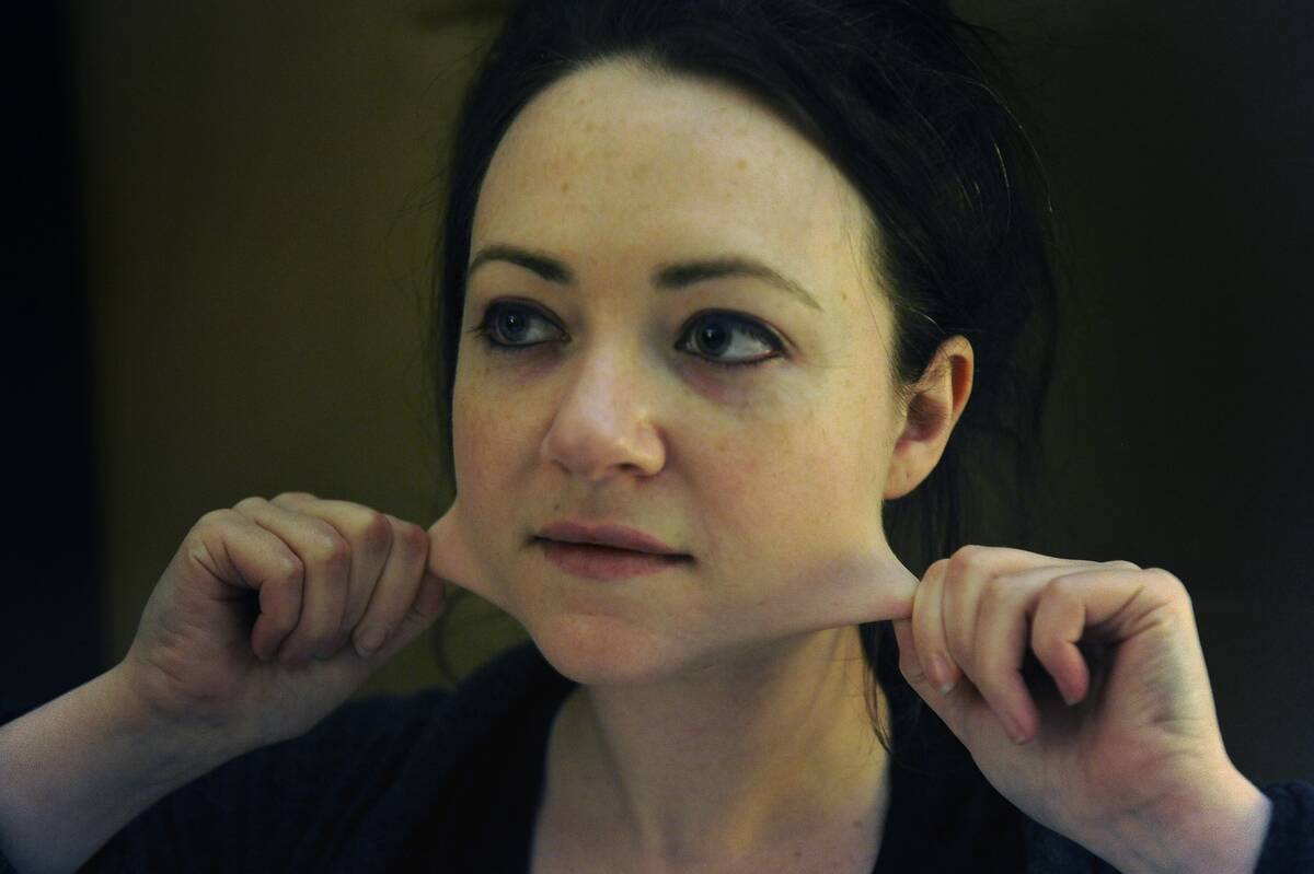 Kelly Koep Suffers From Ehlers-Danlos Syndrome