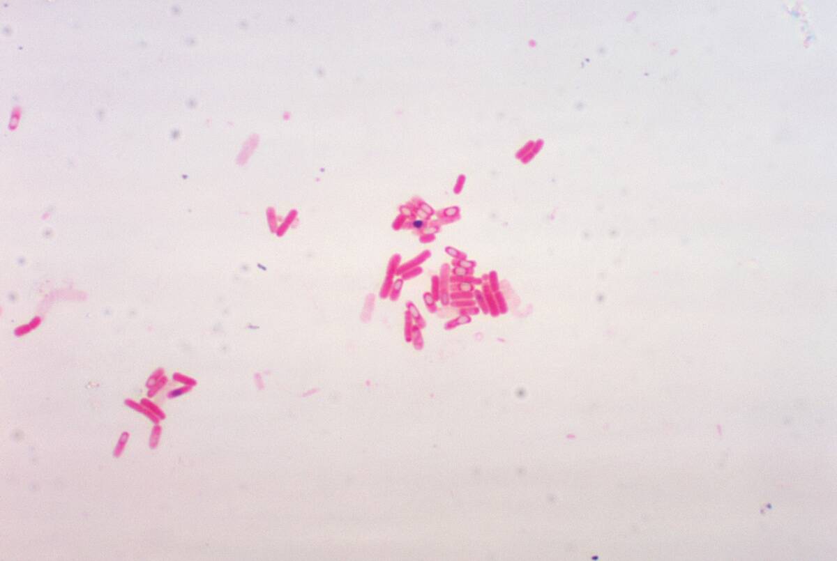 Bacillus Brevis Showing Spores