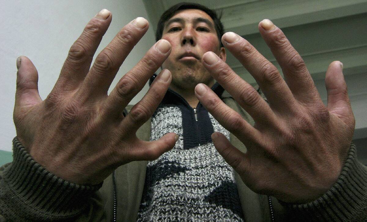 Severe Contamination Blights Kyrgyz Town