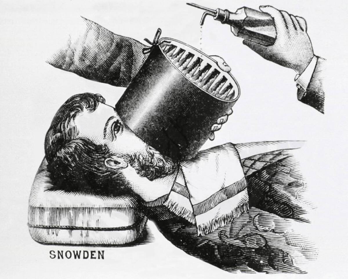 Oscar H. Allis (1836-1931) ether inhaler 1896, to anaesthetize patients, engraving