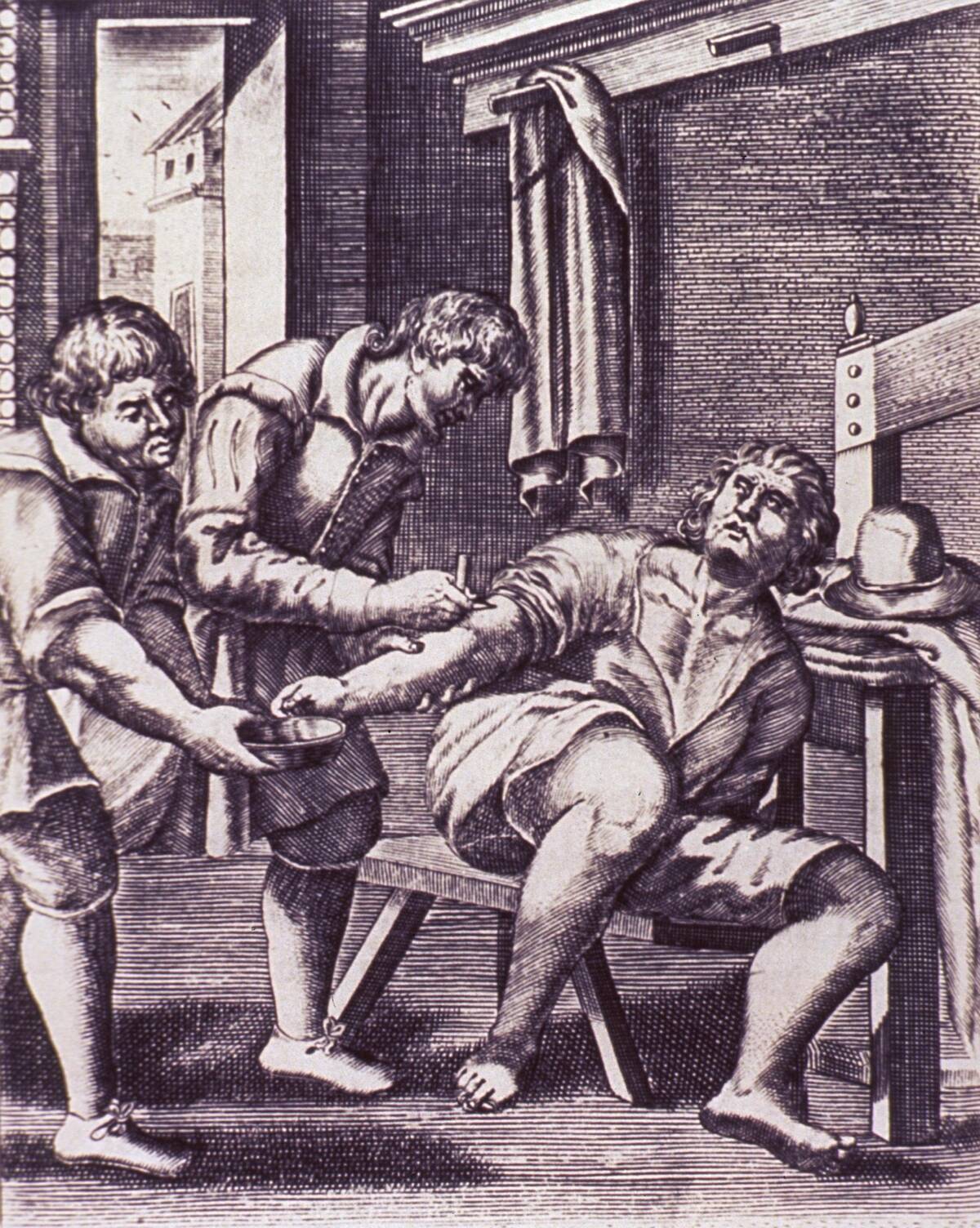 Venesection On Male Patient