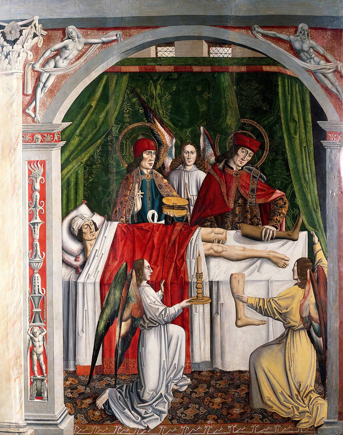 A Vergers Dream: Saints Cosmas And Damian Performing A Miraculous Cure By Transplant...