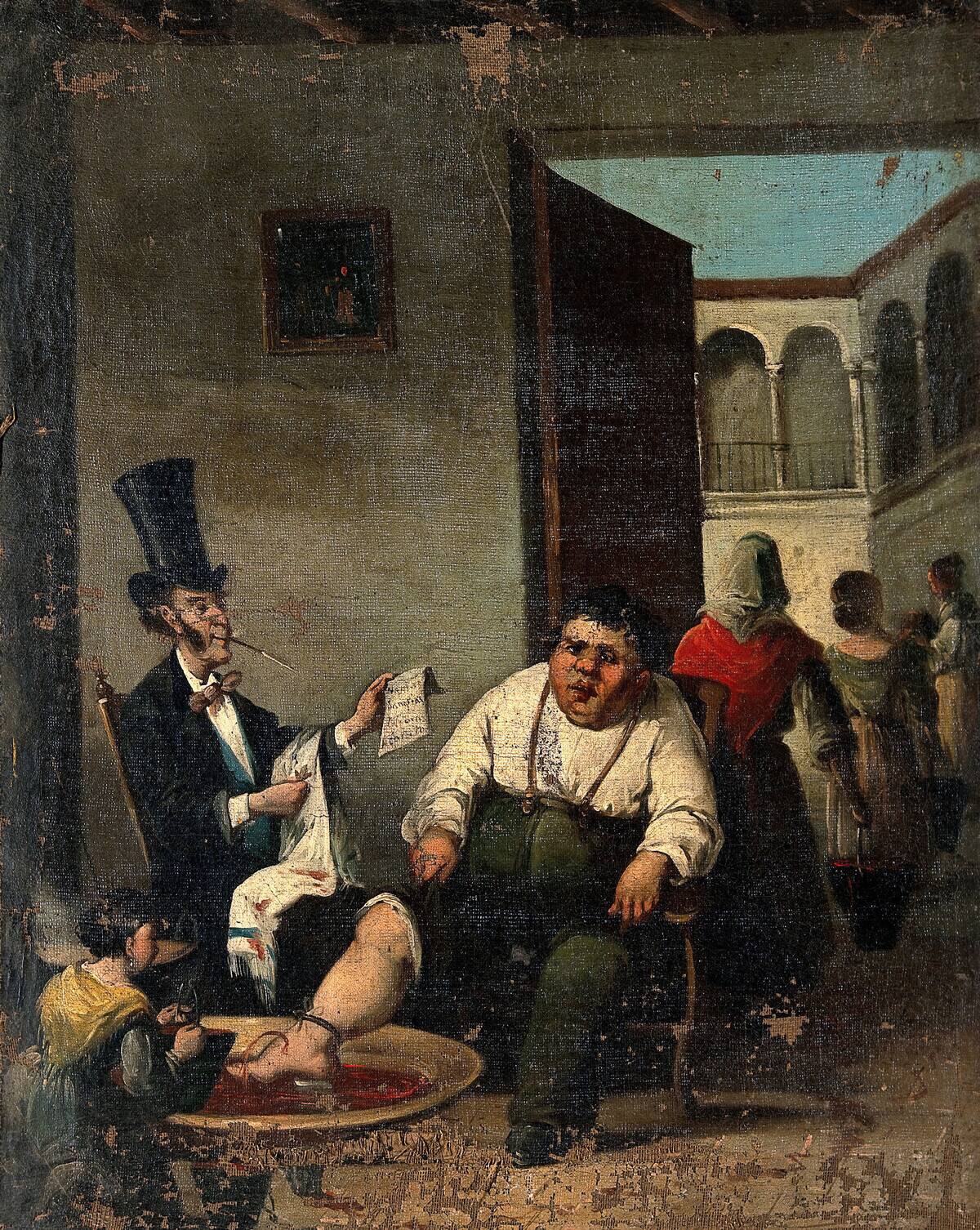 Bloodletting From The Foot. Creator: Daumier