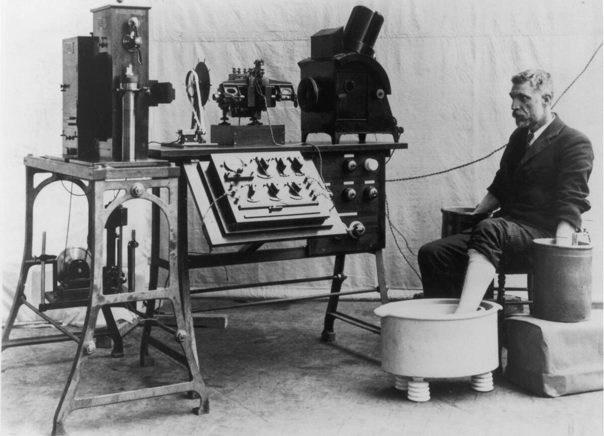 Early Electrocardiogram