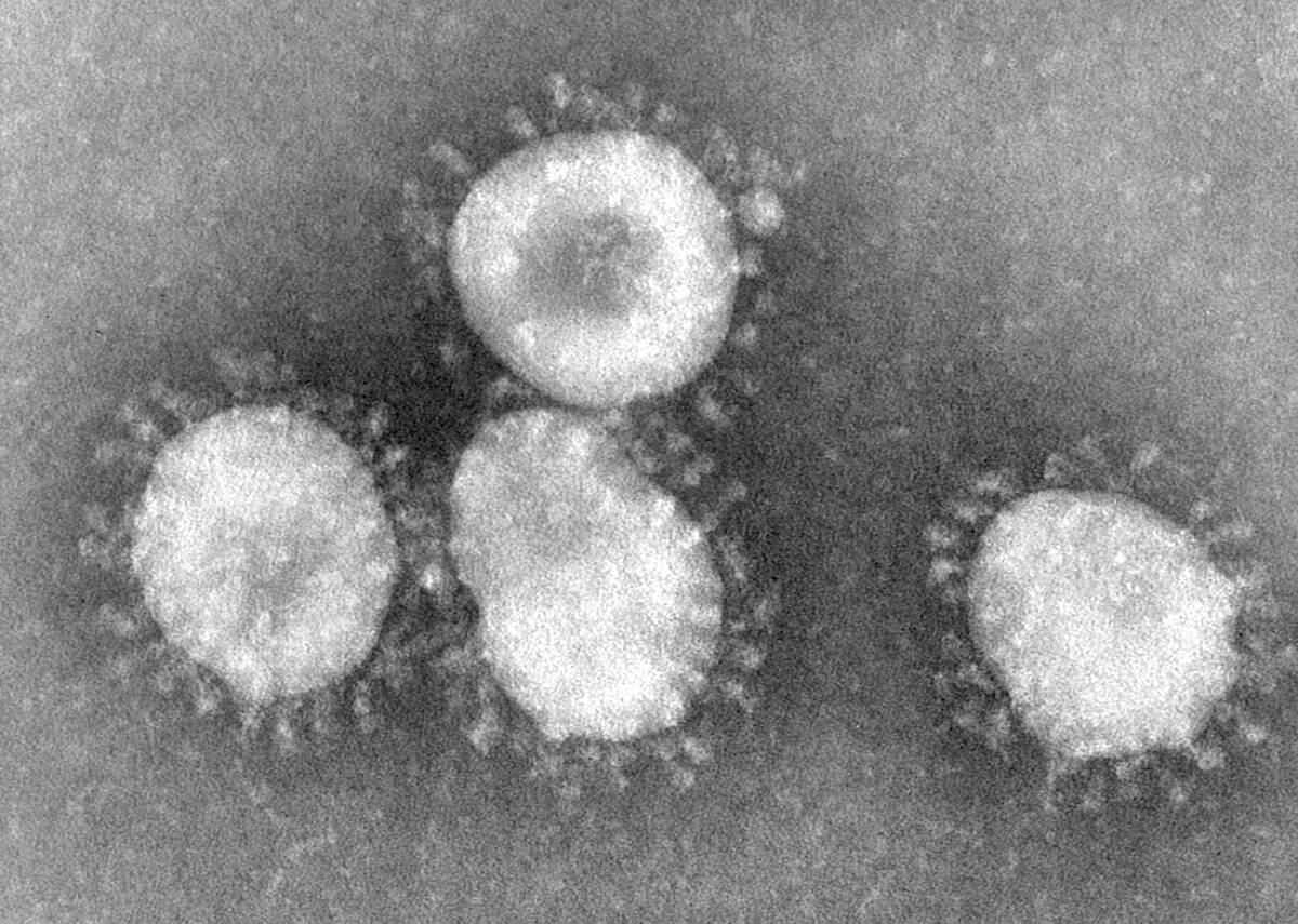 Microscopic View of a Coronavirus