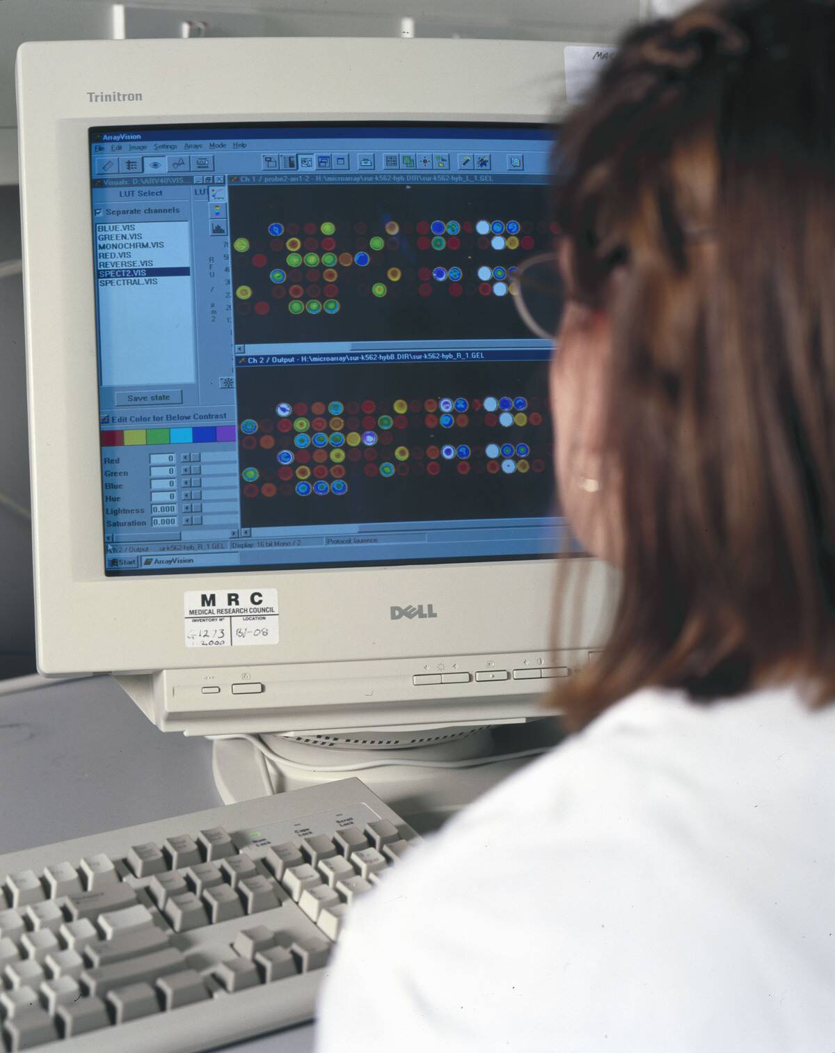 A scientist analysing DNA microarrays.