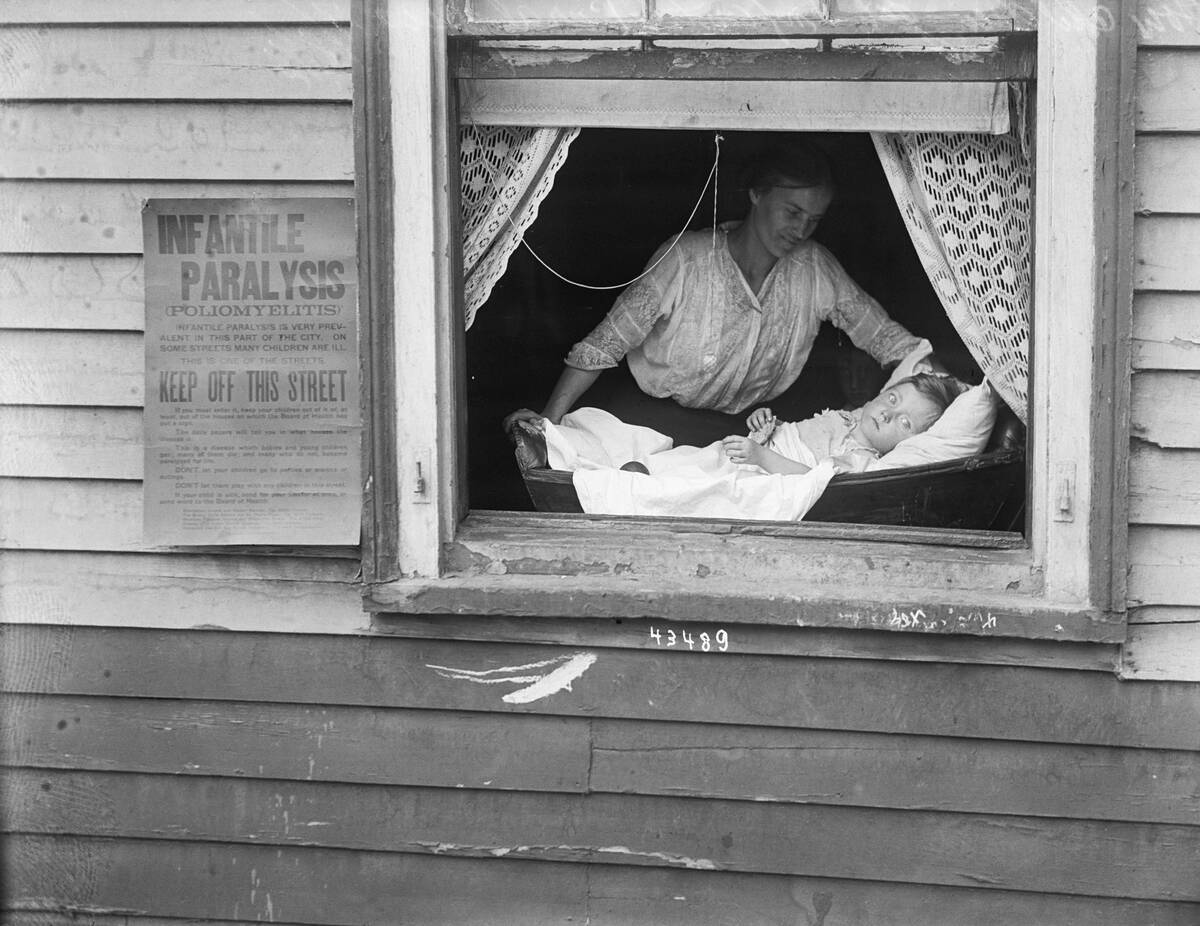 Child with Polio Sitting In Window