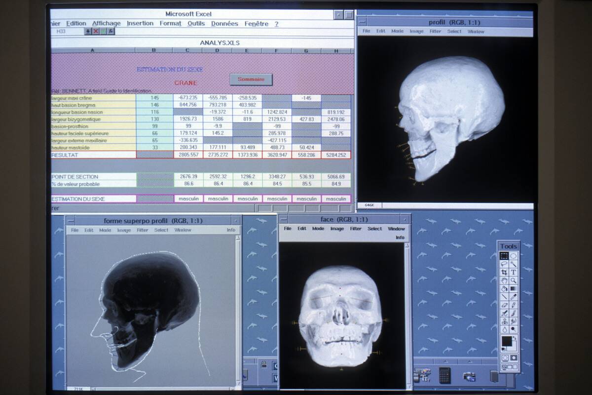 FRA: Otzi The Iceman