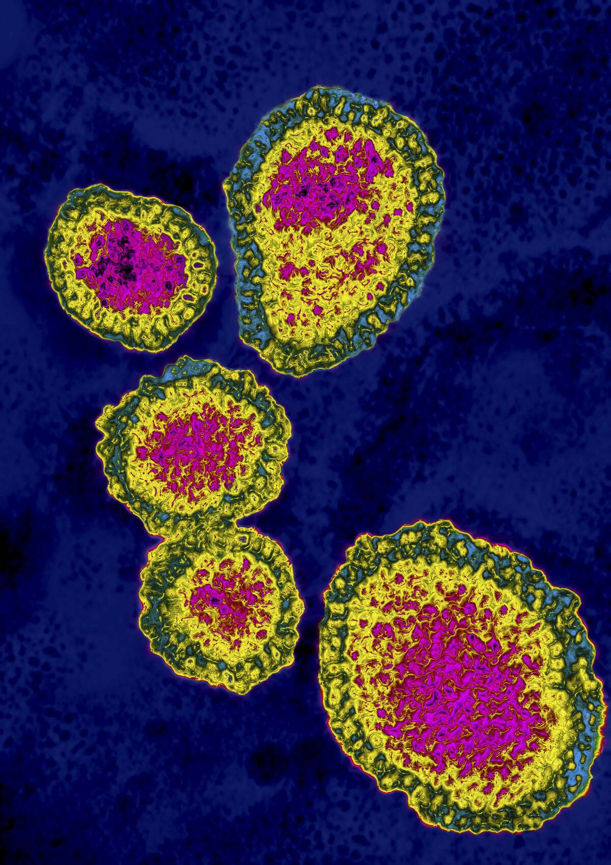 Influenza A H1N1 Virus