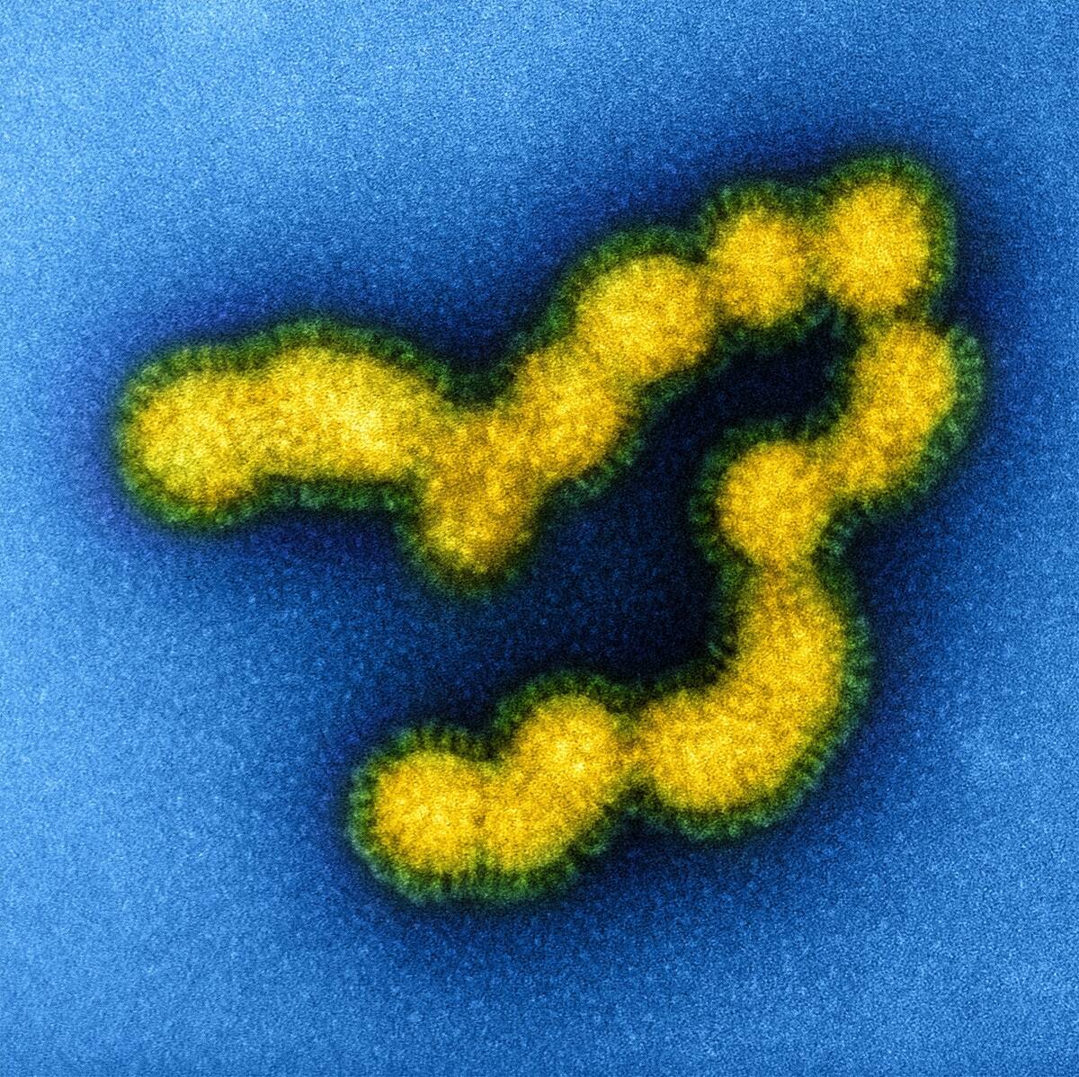 Swine flu strain virus particles