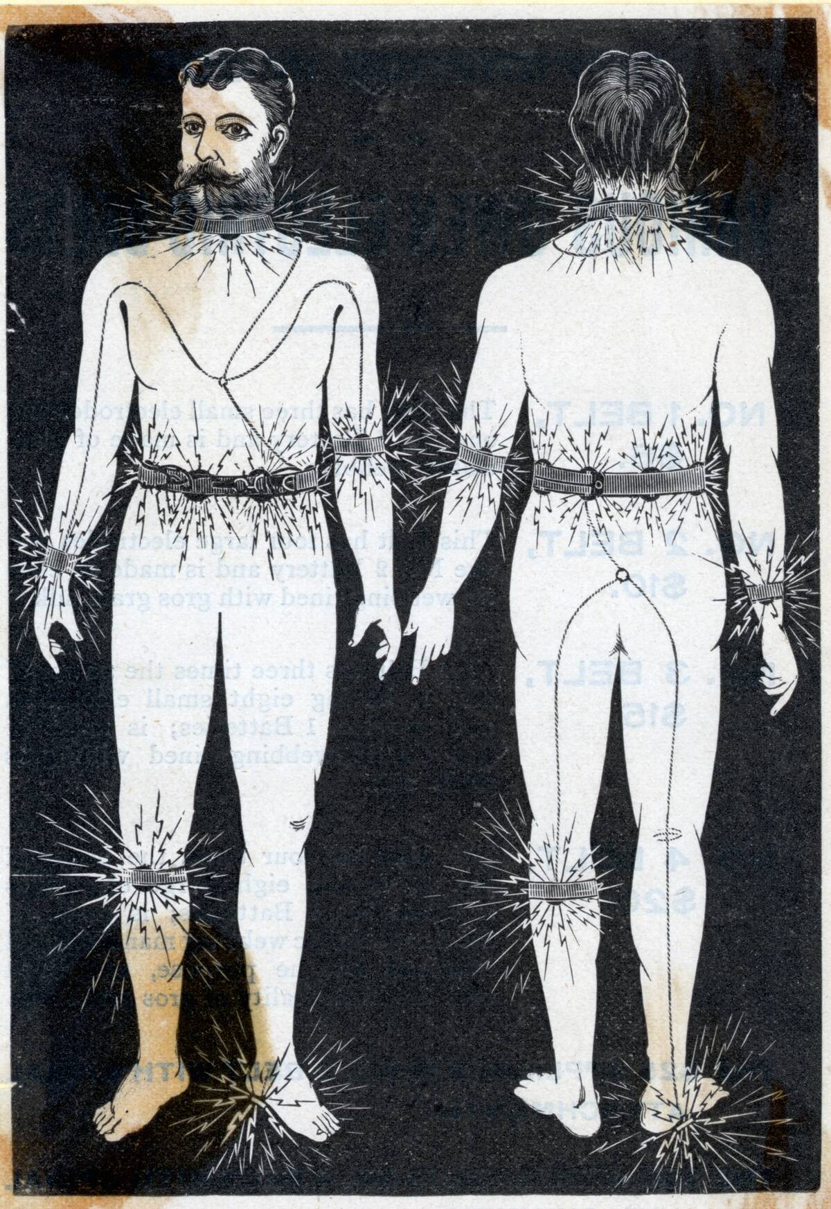 Electrical Belt Miracle Remedy Of 1870S