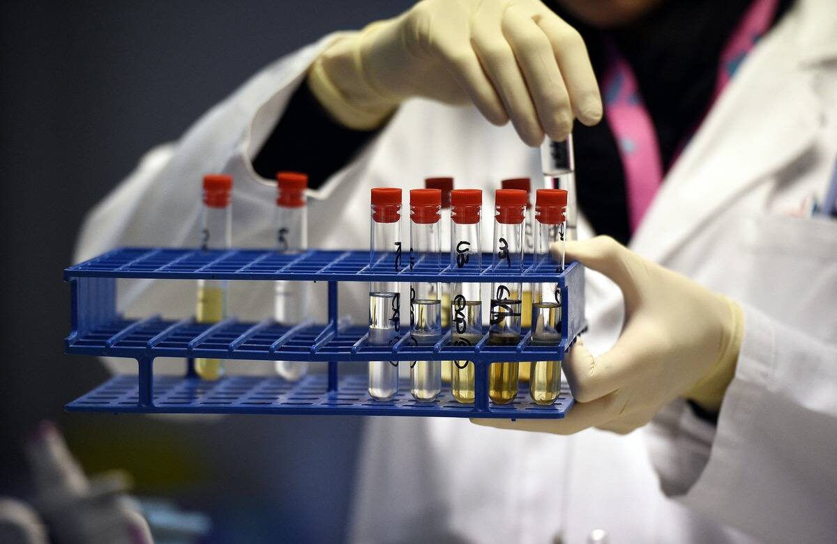 FRANCE-DOPING-LABORATORY