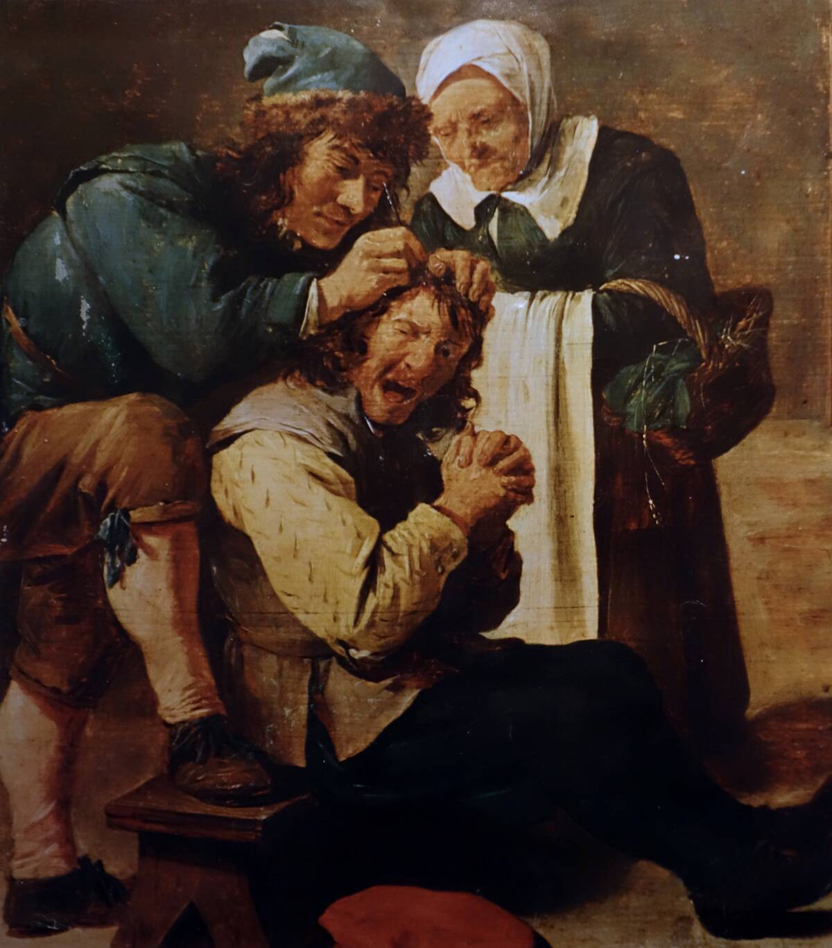 Painting showing trepanation