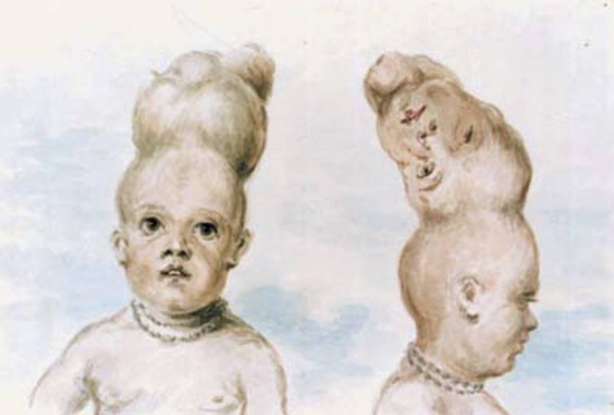 File:TwoHeadedBoyofBengal.jpeg